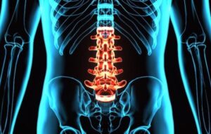 Spinal cord injury